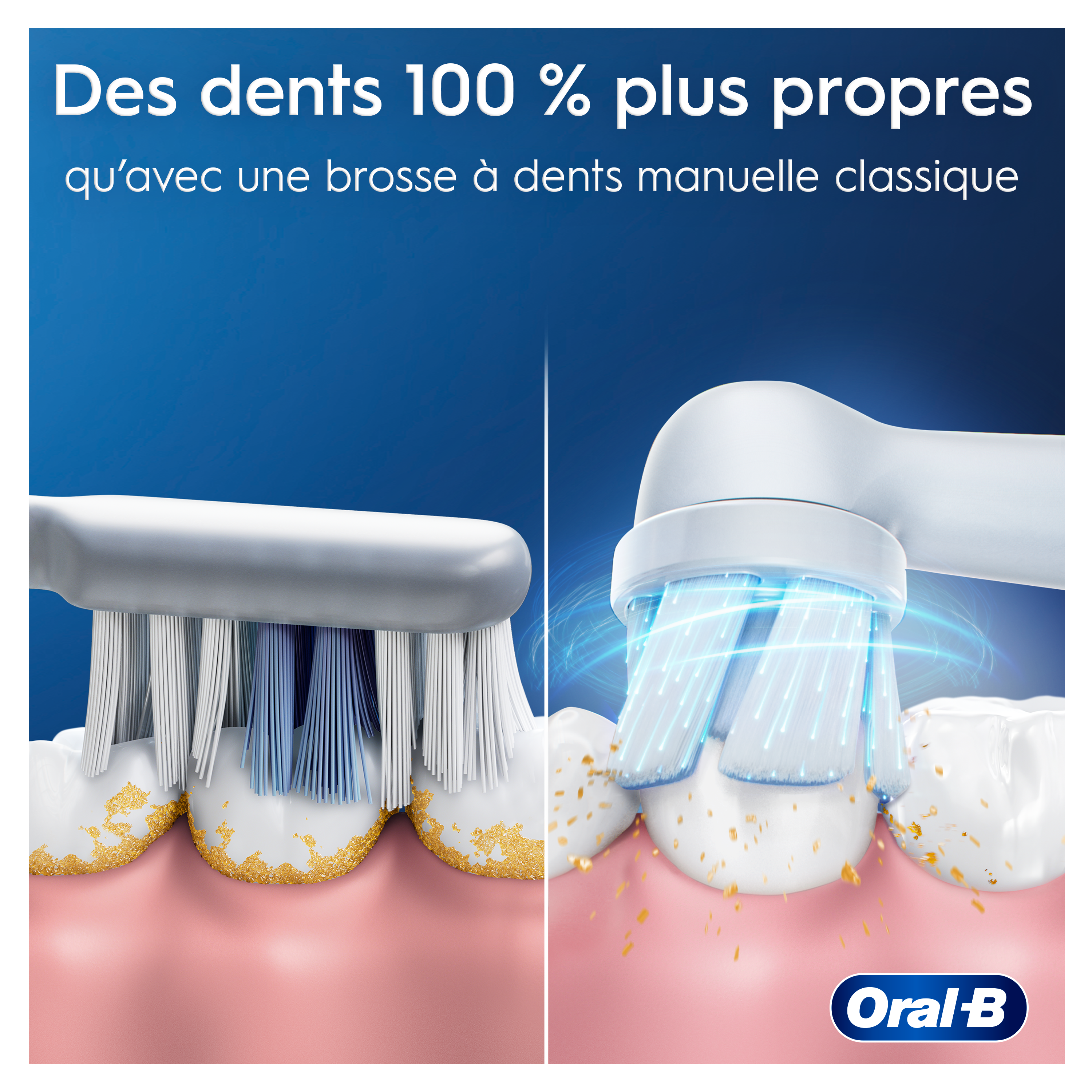 Oral-B iO2 Rose - Brosse à Dents Électrique avec 1 brossette + pack de 4 brossettes